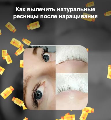 Чем лечить ресницы после наращивания для роста